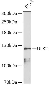 ULK2 Antibody in Western Blot (WB)