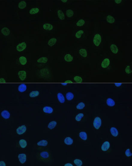 GTF2E1 Antibody in Immunocytochemistry (ICC/IF)