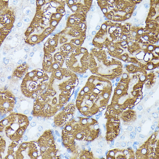 PLS1 Antibody in Immunohistochemistry (Paraffin) (IHC (P))