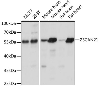 ZNF38 Antibody in Western Blot (WB)