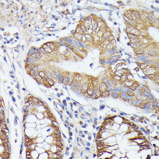 ASC1 Antibody in Immunohistochemistry (Paraffin) (IHC (P))