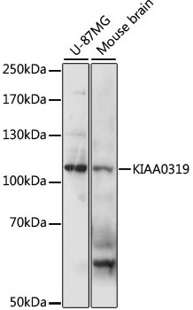 KIAA0319 Antibody in Western Blot (WB)