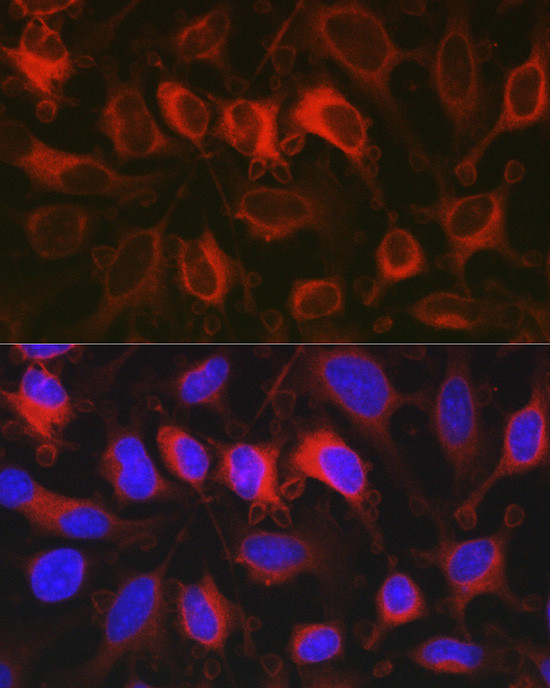 G6PD Antibody in Immunocytochemistry (ICC/IF)