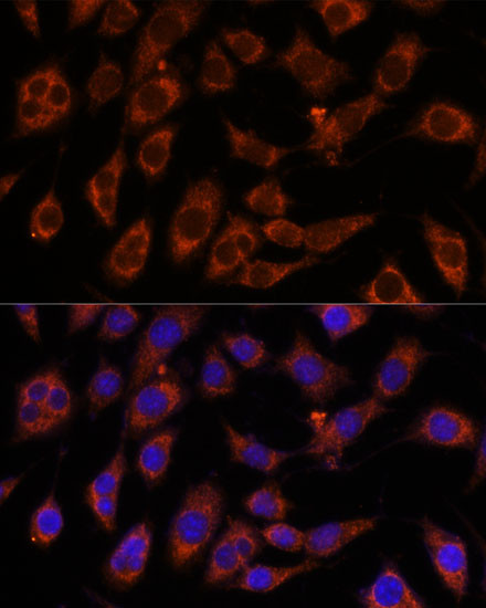 GFPT2 Antibody in Immunocytochemistry (ICC/IF)