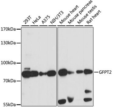 GFPT2 Antibody in Western Blot (WB)