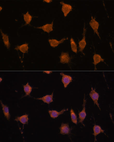 VAV3 Antibody in Immunocytochemistry (ICC/IF)