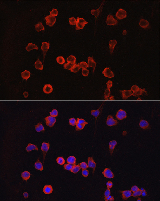 NFATC1 Antibody in Immunocytochemistry (ICC/IF)