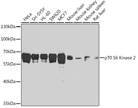 RPS6KB2 Antibody in Western Blot (WB)