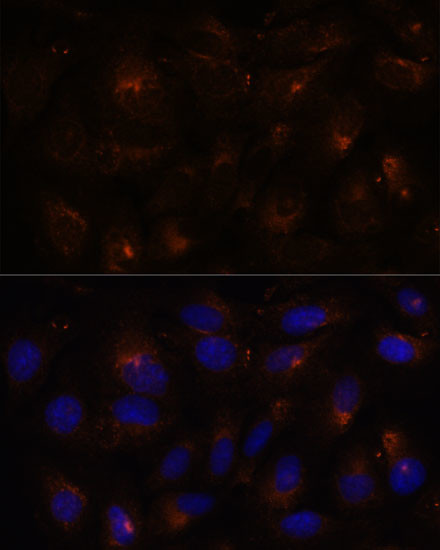 FAM62A Antibody in Immunocytochemistry (ICC/IF)
