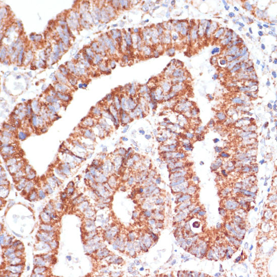 MRPL46 Antibody in Immunohistochemistry (Paraffin) (IHC (P))