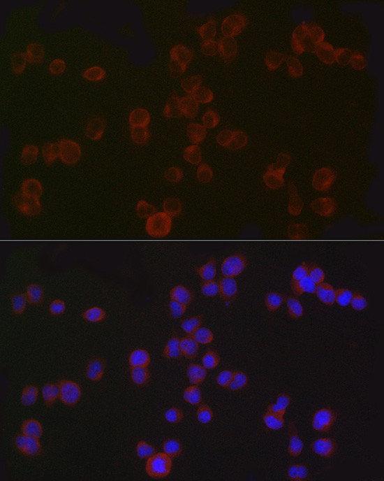 CD4 Antibody in Immunocytochemistry (ICC/IF)