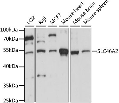 TSCOT Antibody in Western Blot (WB)