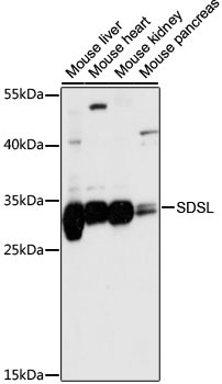 SDSL Antibody in Western Blot (WB)