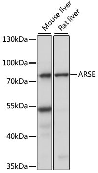 Arylsulfatase E Antibody in Western Blot (WB)