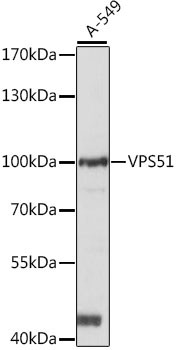 VPS51 Antibody in Western Blot (WB)