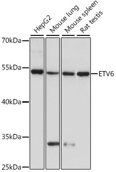 ETV6 Antibody in Western Blot (WB)