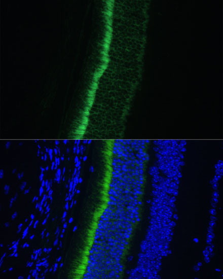 GNGT1 Antibody in Immunohistochemistry (Paraffin) (IHC (P))