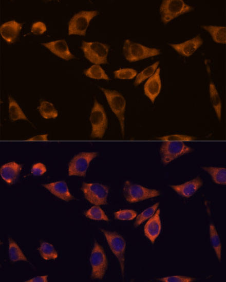 IL10RB Antibody in Immunocytochemistry (ICC/IF)