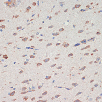 Neuroserpin Antibody in Immunohistochemistry (Paraffin) (IHC (P))
