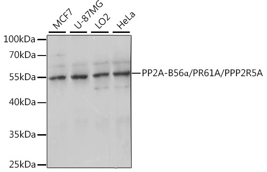 PPP2R5A Antibody in Western Blot (WB)