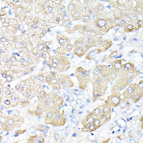 Haptoglobin Antibody in Immunohistochemistry (Paraffin) (IHC (P))