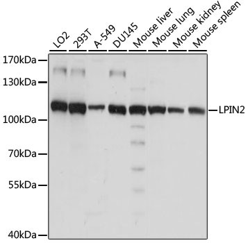 LPIN2 Antibody in Western Blot (WB)