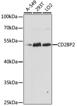 CD2BP2 Antibody in Western Blot (WB)