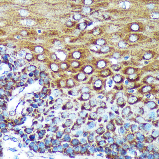 SPECC1L Antibody in Immunohistochemistry (Paraffin) (IHC (P))