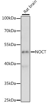 CCRN4L Antibody in Western Blot (WB)