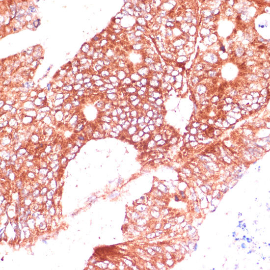 FAM98A Antibody in Immunohistochemistry (Paraffin) (IHC (P))