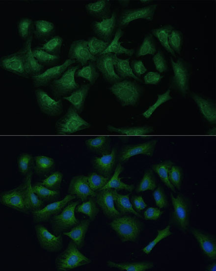 REXO2 Antibody in Immunocytochemistry (ICC/IF)