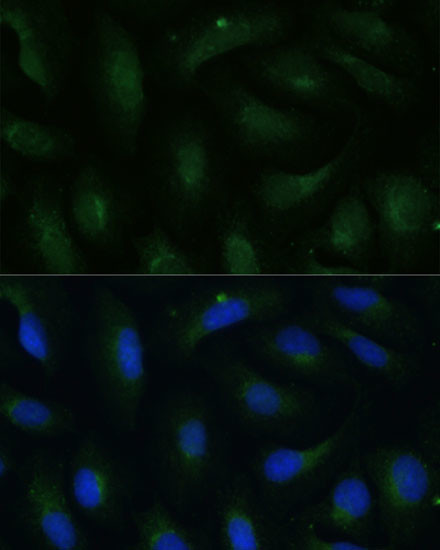 COPG2 Antibody in Immunocytochemistry (ICC/IF)