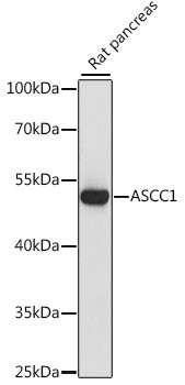 ASCC1 Antibody in Western Blot (WB)