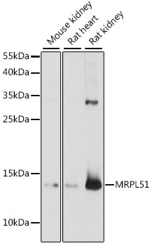 MRPL51 Antibody in Western Blot (WB)