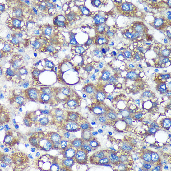 C3orf1 Antibody in Immunohistochemistry (Paraffin) (IHC (P))