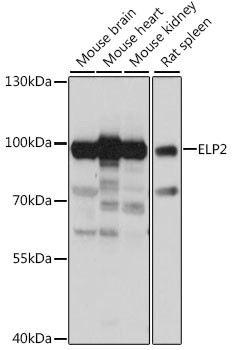 ELP2 Antibody in Western Blot (WB)
