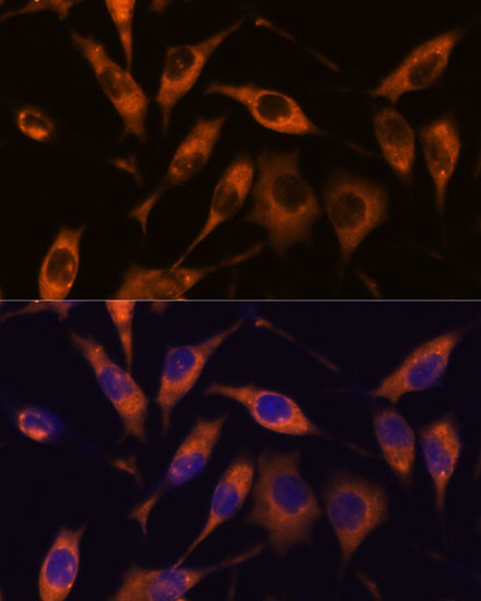 ATL2 Antibody in Immunocytochemistry (ICC/IF)
