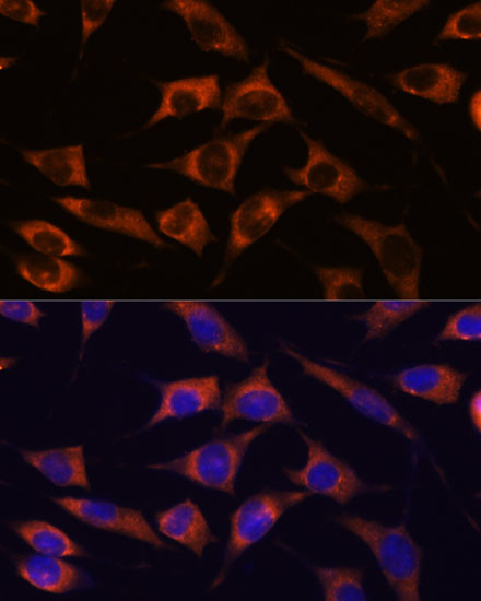 MMP25 Antibody in Immunocytochemistry (ICC/IF)