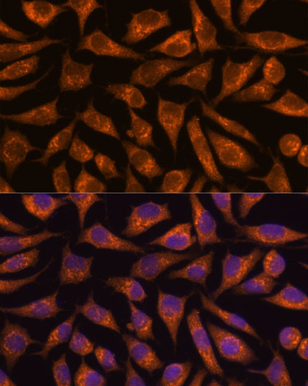 B3GNT4 Antibody in Immunocytochemistry (ICC/IF)