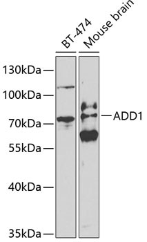 alpha Adducin Antibody in Western Blot (WB)