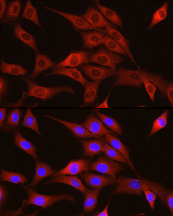 TRIM4 Antibody in Immunocytochemistry (ICC/IF)