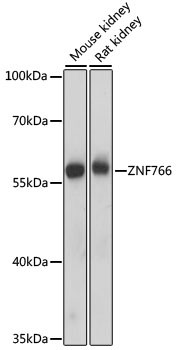 ZNF766 Antibody in Western Blot (WB)