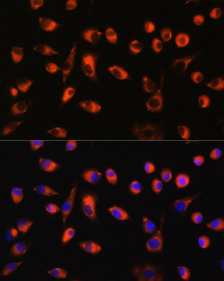 TMEM44 Antibody in Immunocytochemistry (ICC/IF)
