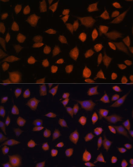 ARMC6 Antibody in Immunocytochemistry (ICC/IF)