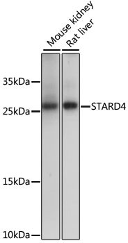 STARD4 Antibody in Western Blot (WB)
