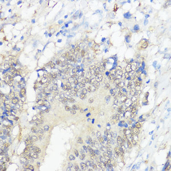 GPX2 Antibody in Immunohistochemistry (Paraffin) (IHC (P))