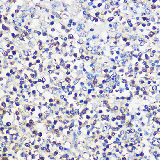 CD80 Antibody in Immunohistochemistry (Paraffin) (IHC (P))