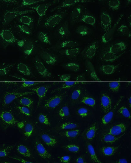 ETFB Antibody in Immunocytochemistry (ICC/IF)