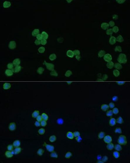 CD42b Antibody in Immunocytochemistry (ICC/IF)