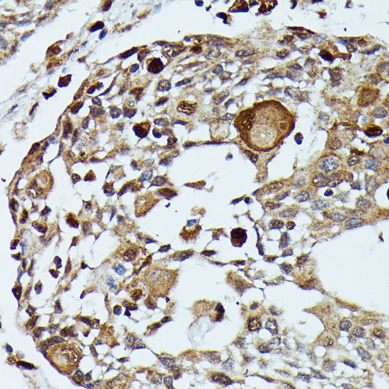 MEKK3 Antibody in Immunohistochemistry (Paraffin) (IHC (P))